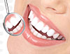 Wellnesstop - bělení zubů